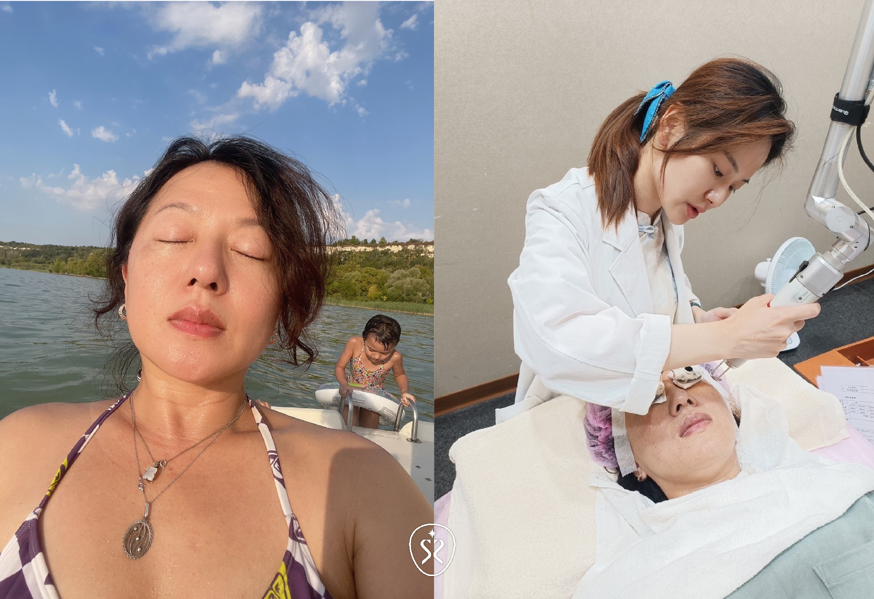 【水光注射】